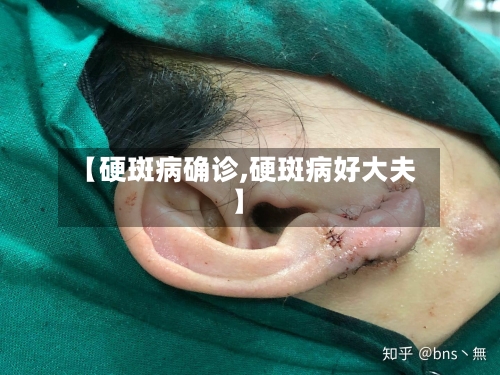 【硬斑病确诊,硬斑病好大夫】-第2张图片