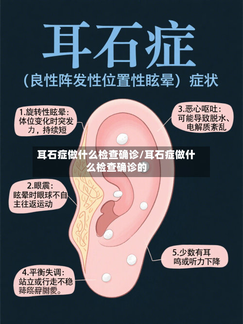 耳石症做什么检查确诊/耳石症做什么检查确诊的-第3张图片