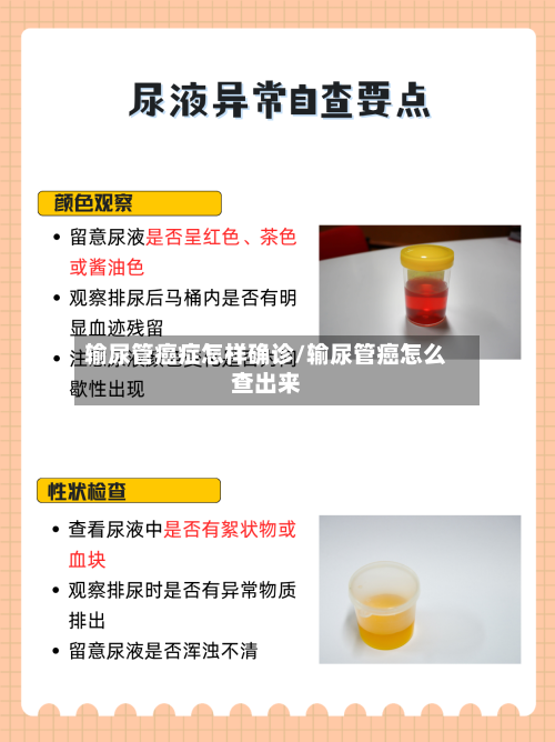 输尿管癌症怎样确诊/输尿管癌怎么查出来-第2张图片