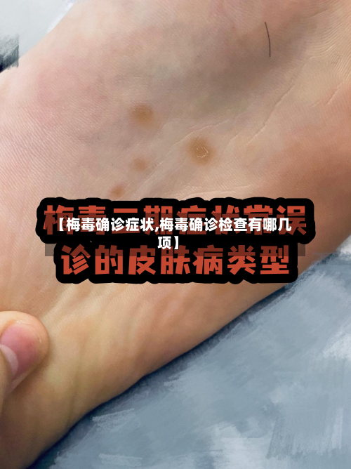 【梅毒确诊症状,梅毒确诊检查有哪几项】