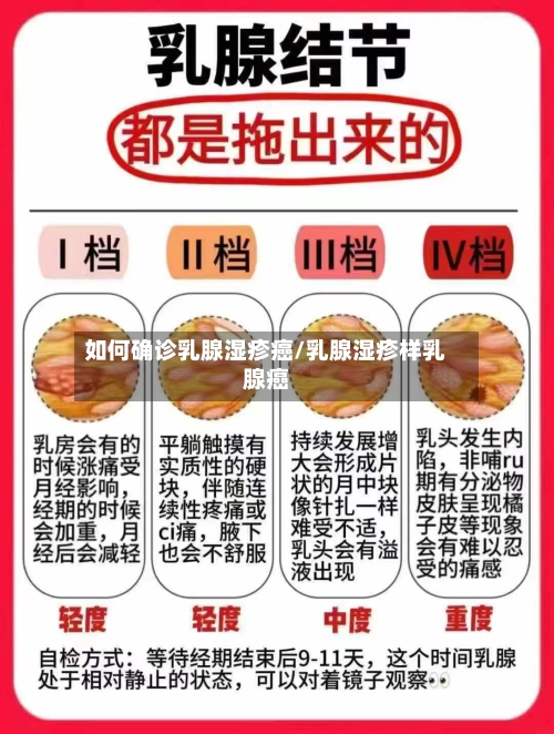 如何确诊乳腺湿疹癌/乳腺湿疹样乳腺癌-第3张图片