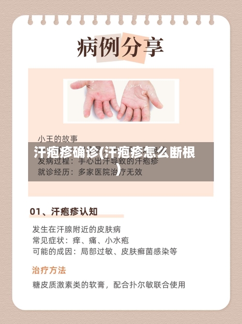 汗疱疹确诊(汗疱疹怎么断根)