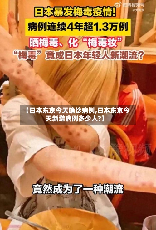 【日本东京今天确诊病例,日本东京今天新增病例多少人?】