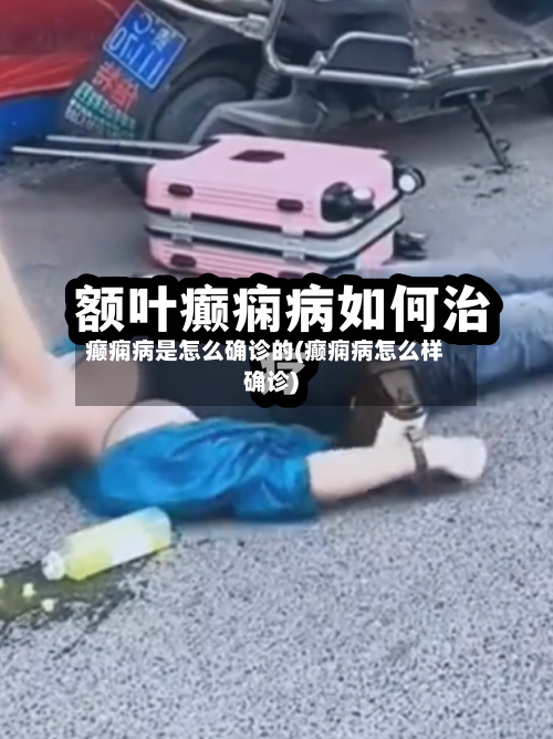 癫痫病是怎么确诊的(癫痫病怎么样确诊)
