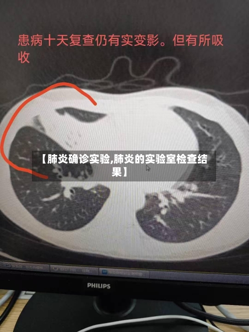 【肺炎确诊实验,肺炎的实验室检查结果】