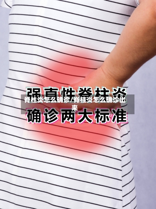 脊柱炎怎么确诊/脊柱炎怎么确诊出来
