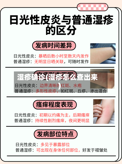 湿疹确诊(湿疹怎么查出来)-第2张图片