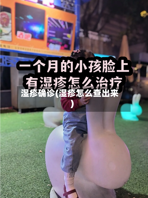 湿疹确诊(湿疹怎么查出来)-第3张图片