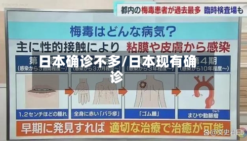 日本确诊不多/日本现有确诊-第2张图片