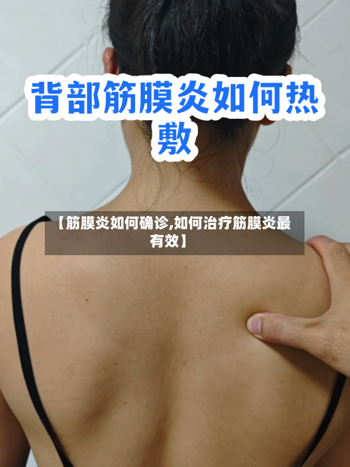 【筋膜炎如何确诊,如何治疗筋膜炎最有效】-第2张图片