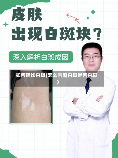 如何确诊白斑(怎么判断白斑是否白斑)