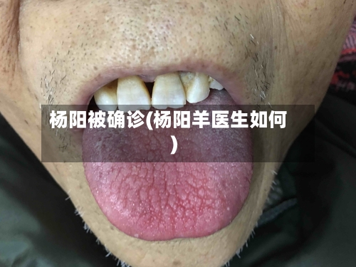 杨阳被确诊(杨阳羊医生如何)-第2张图片