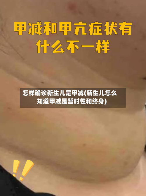 怎样确诊新生儿是甲减(新生儿怎么知道甲减是暂时性和终身)-第2张图片