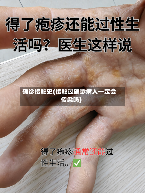 确诊接触史(接触过确诊病人一定会传染吗)