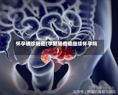 怀孕确诊肠癌(孕期肠癌能继续怀孕吗)