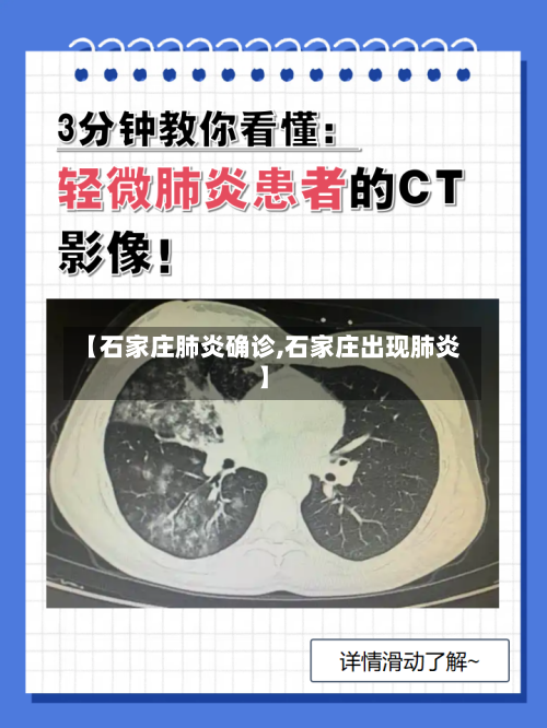 【石家庄肺炎确诊,石家庄出现肺炎】-第3张图片