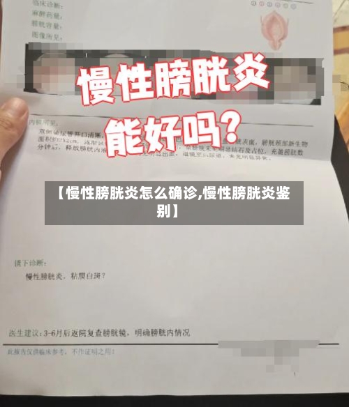 【慢性膀胱炎怎么确诊,慢性膀胱炎鉴别】