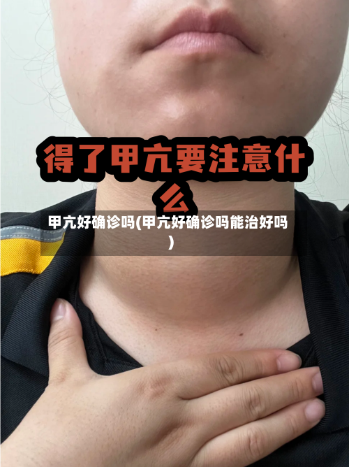 甲亢好确诊吗(甲亢好确诊吗能治好吗)