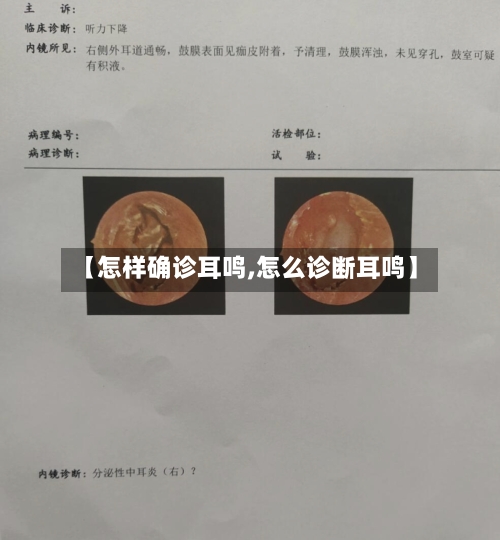 【怎样确诊耳鸣,怎么诊断耳鸣】-第2张图片