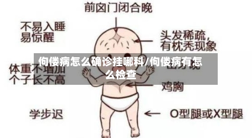 佝偻病怎么确诊挂哪科/佝偻病有怎么检查-第2张图片