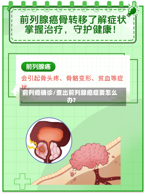 前列癌确诊/查出前列腺癌症要怎么办?-第2张图片