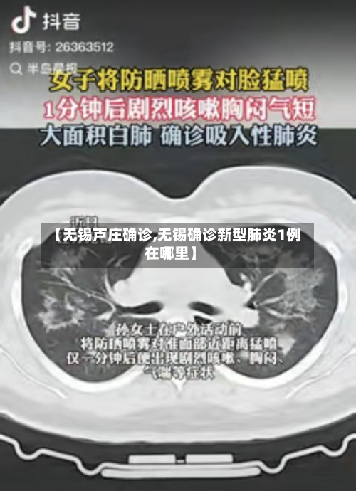 【无锡芦庄确诊,无锡确诊新型肺炎1例在哪里】