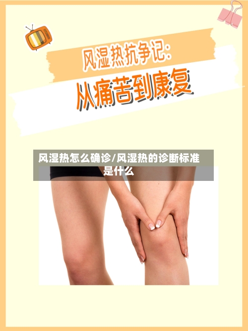 风湿热怎么确诊/风湿热的诊断标准是什么-第2张图片