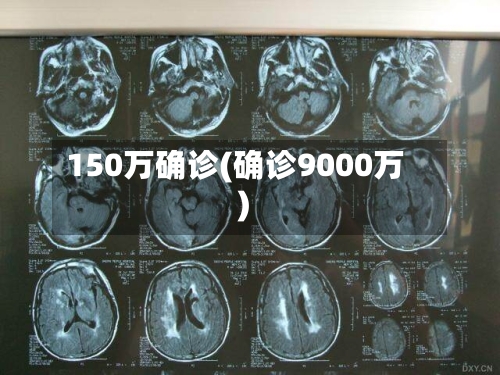 150万确诊(确诊9000万)-第2张图片