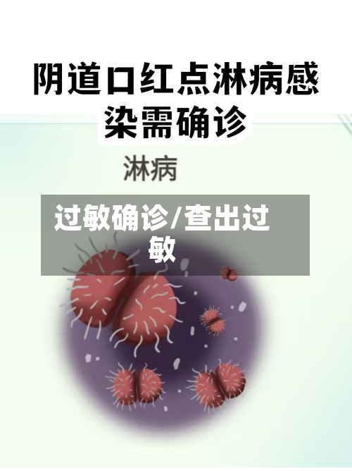 过敏确诊/查出过敏