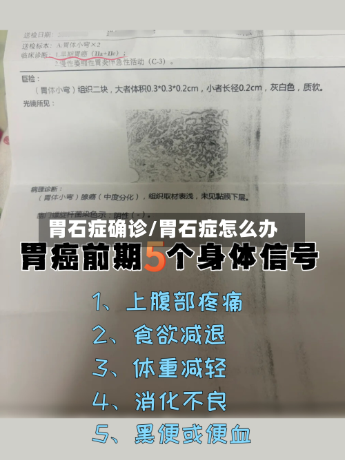 胃石症确诊/胃石症怎么办