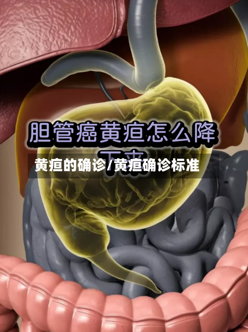 黄疸的确诊/黄疸确诊标准
