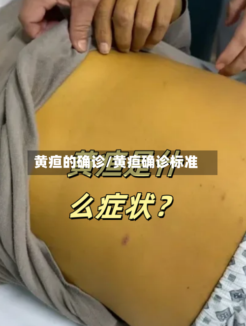 黄疸的确诊/黄疸确诊标准-第3张图片