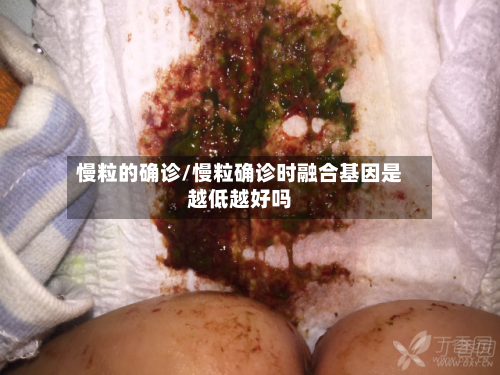 慢粒的确诊/慢粒确诊时融合基因是越低越好吗