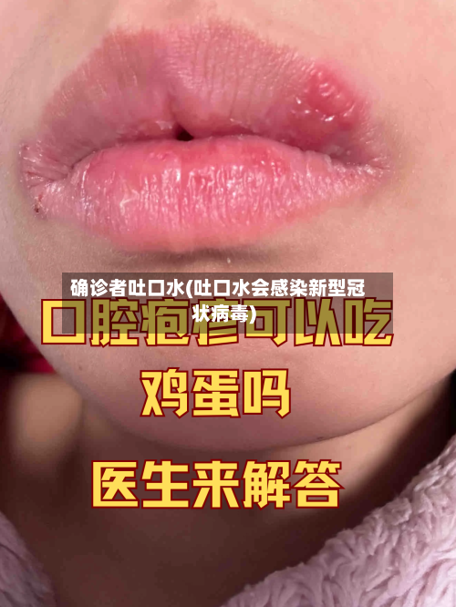 确诊者吐口水(吐口水会感染新型冠状病毒)