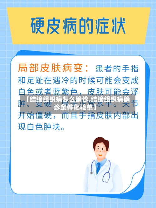 【结缔组织病怎么确诊,结缔组织病确诊条件化验单】