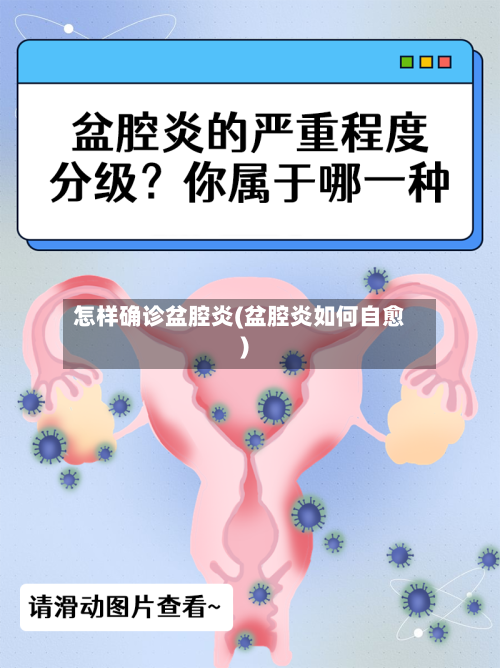 怎样确诊盆腔炎(盆腔炎如何自愈)