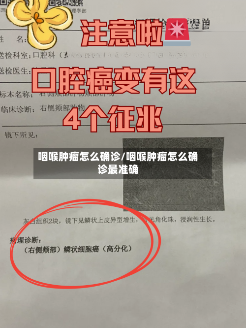 咽喉肿瘤怎么确诊/咽喉肿瘤怎么确诊最准确-第2张图片