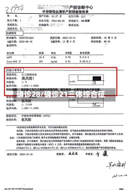 确诊28/确诊21三体综合征-第2张图片