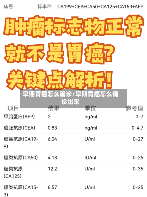 早期胃癌怎么确诊/早期胃癌怎么确诊出来