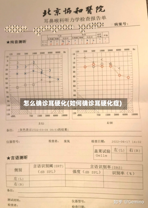 怎么确诊耳硬化(如何确诊耳硬化症)-第3张图片