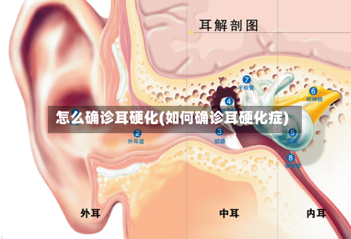 怎么确诊耳硬化(如何确诊耳硬化症)-第2张图片