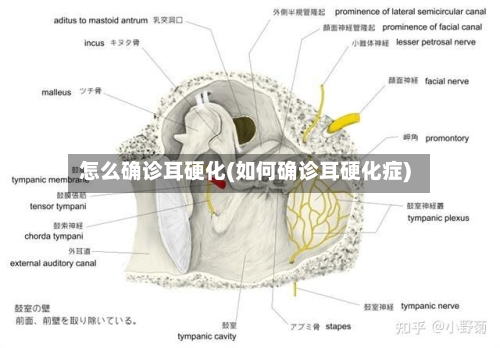 怎么确诊耳硬化(如何确诊耳硬化症)