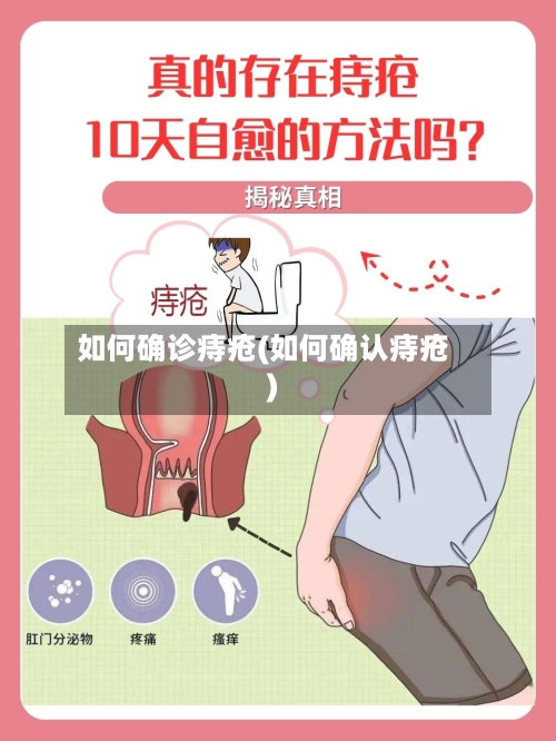 如何确诊痔疮(如何确认痔疮)-第3张图片