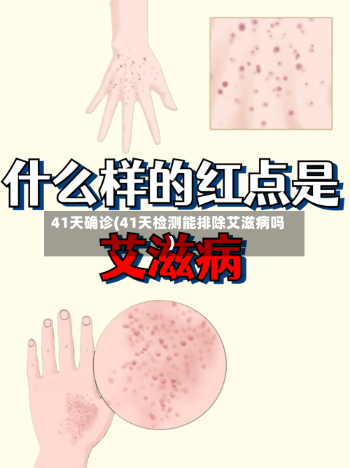 41天确诊(41天检测能排除艾滋病吗)-第3张图片