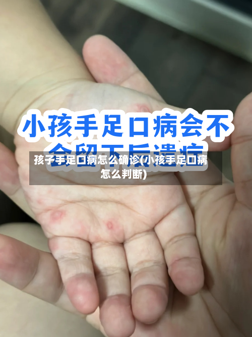 孩子手足口病怎么确诊(小孩手足口病怎么判断)