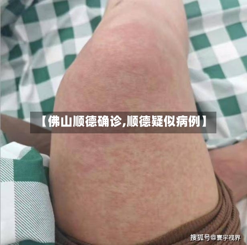 【佛山顺德确诊,顺德疑似病例】-第2张图片