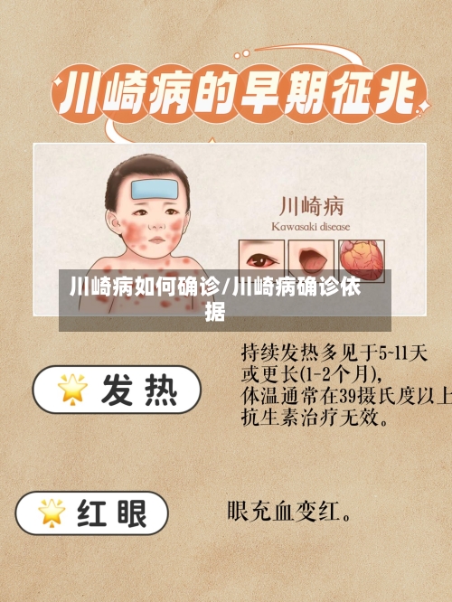 川崎病如何确诊/川崎病确诊依据