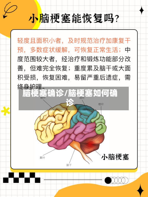 脑梗塞确诊/脑梗塞如何确诊