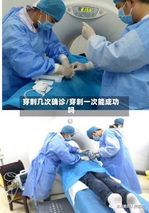 穿刺几次确诊/穿刺一次能成功吗