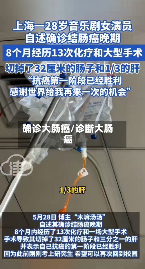 确诊大肠癌/诊断大肠癌